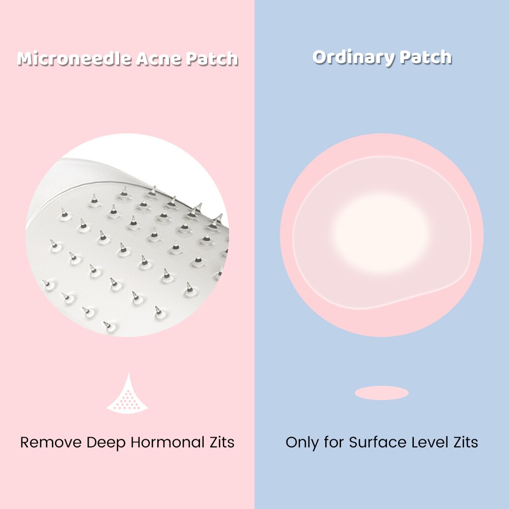 9pcs Translucent Microneedle Pimple Patch Acne Master Treatment Sticker Face Beauty Skin Care Tool Tape Skincare